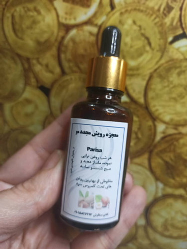 معجزه رویش مجدد مو parisa